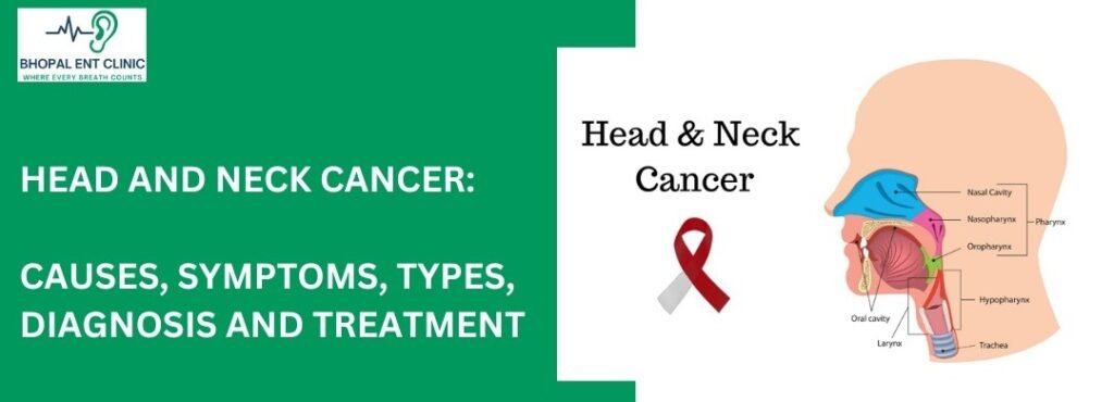 Diagram about head and neck cancer with a ribbon, symptoms, causes, and treatment details from Bhopal ENT Clinic.