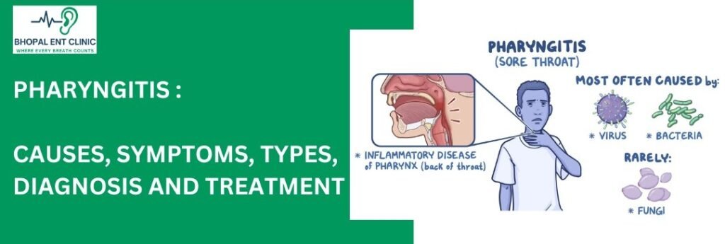 Graphic for Bhopal ENT Clinic titled "Pharyngitis: Causes, Symptoms, Types, Diagnosis and Treatment". The image includes a logo of Bhopal ENT Clinic with the slogan "Where Every Breath Counts" and an illustration showing an inflamed pharynx, a person holding their throat, and common causes of pharyngitis like viruses, bacteria, and fungi.